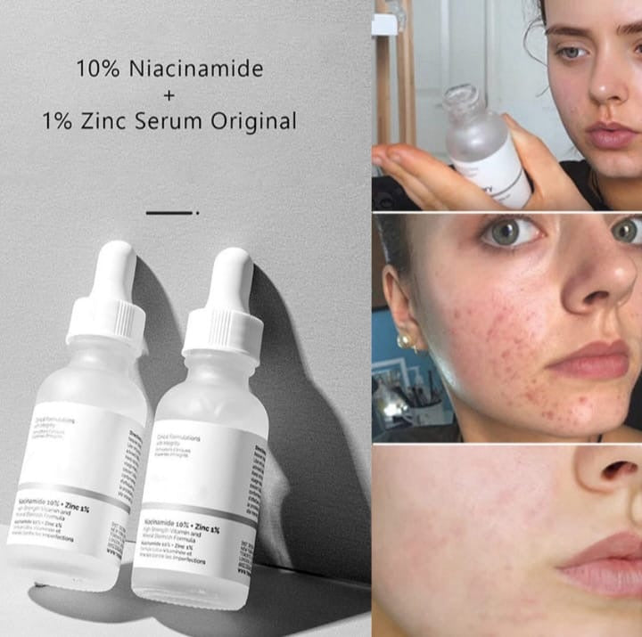 The Ordinary Niacinamide 10% + Zinc 1% Face Serum
